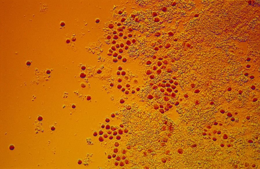 Porphyridium Sp. Red Algae, Lm #1 Photograph by Michael Abbey