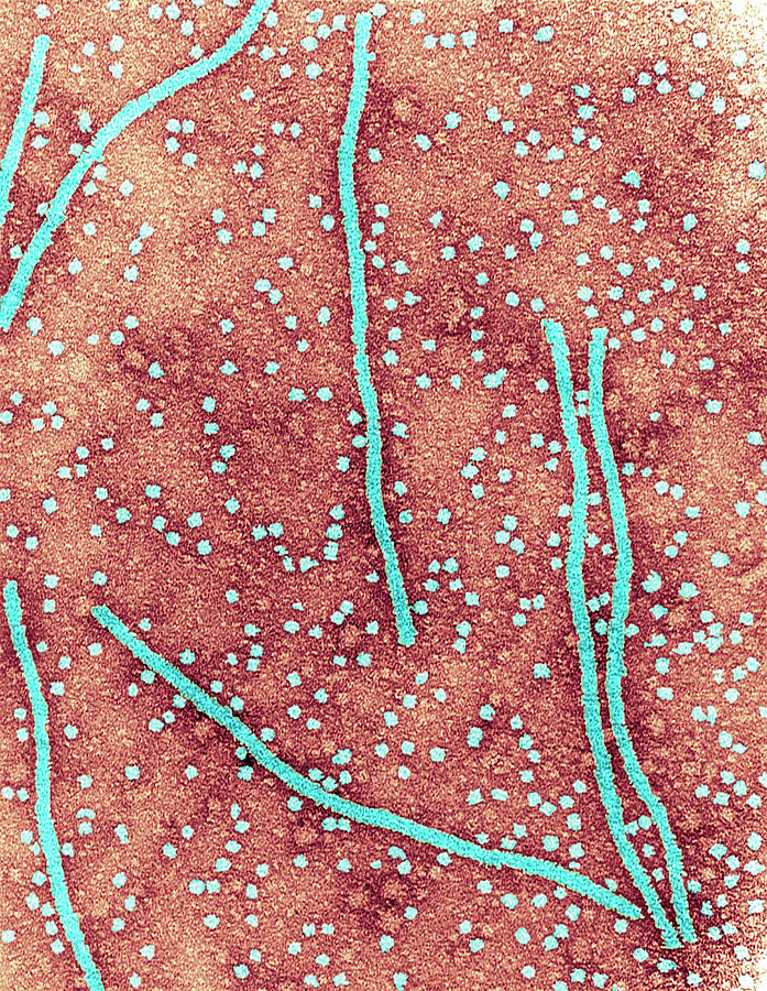 Potato X Virus Photograph by Centre For Bioimaging, Rothamsted Research