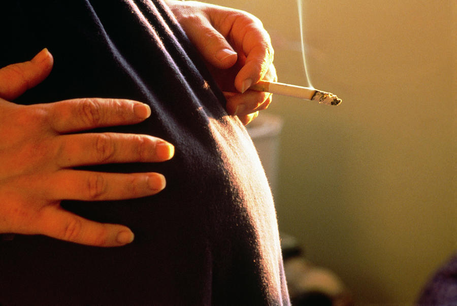 Smoking Photograph - Pregnant Woman Smoking A Cigarette. #1 by Adam Hart-davis/science Photo Library