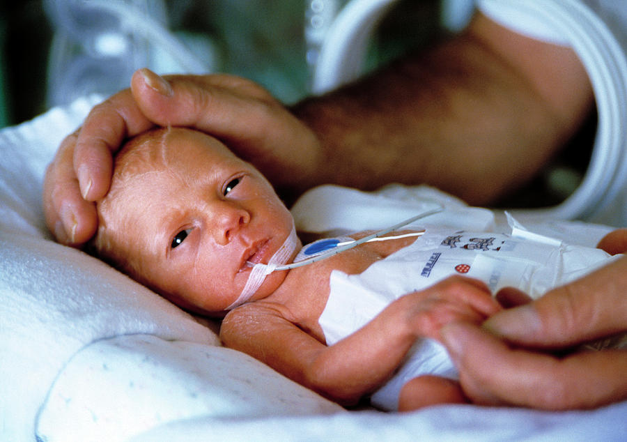 Premature Baby Photograph By John Cole Science Photo Library Pixels