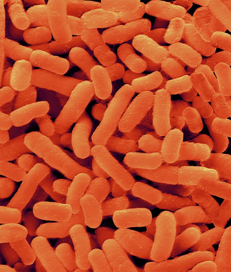 Prevotella Intermedia 1 Photograph by Science Photo Library Pixels