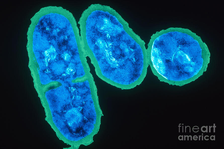 Propionibacterium Acnes, Tem #1 Photograph by Kwangshin Kim