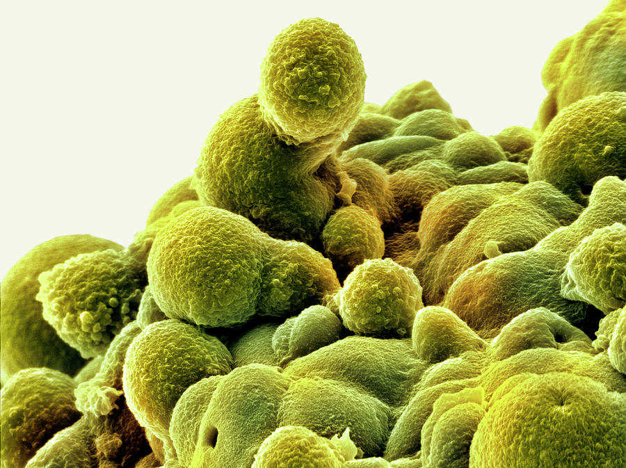 Prostate Cancer Cells #1 Photograph by David Mccarthy