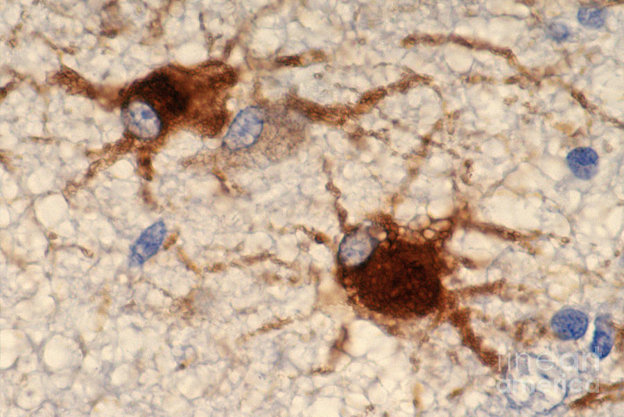 Protoplasmic Astrocytes #1 Photograph by Ralph C. Eagle, Jr.