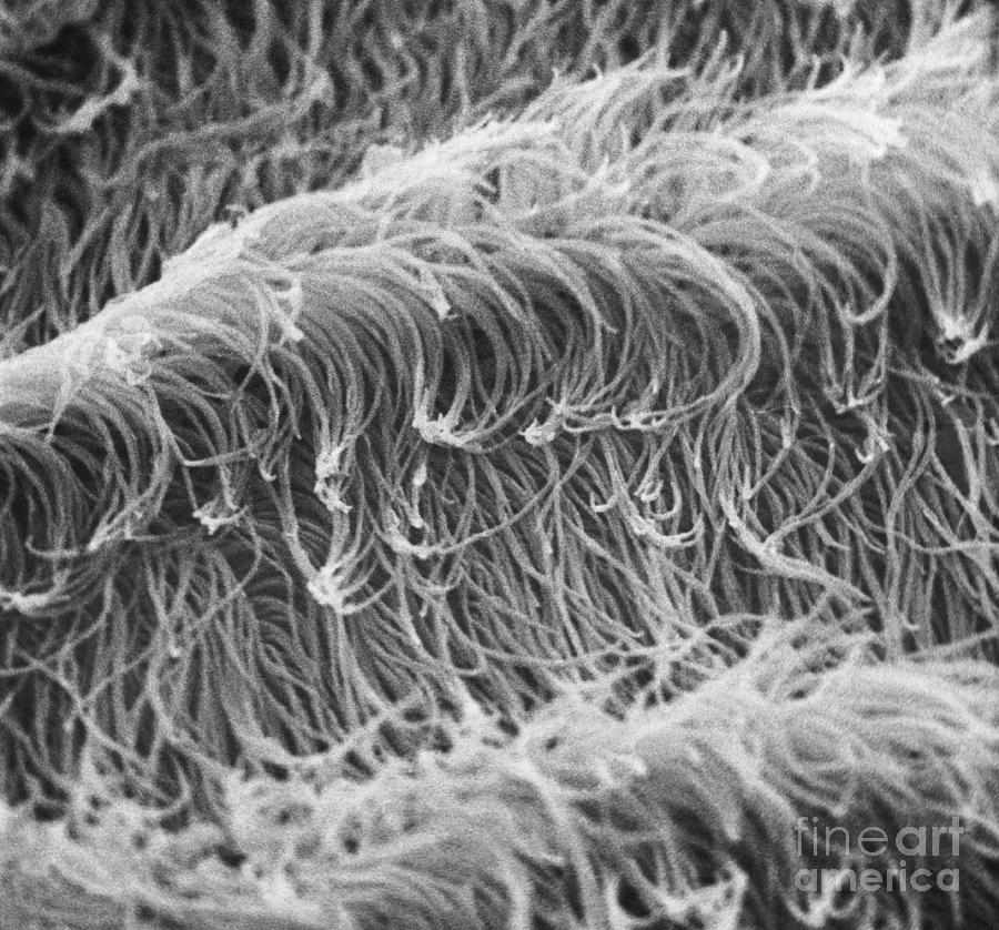 Protozoan Cilia Sem #1 Photograph by David M. Phillips