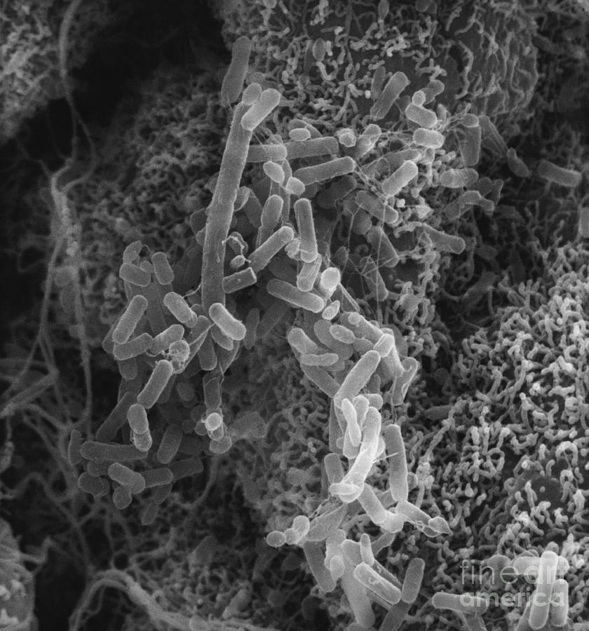 Scanning Electron Micrograph Photograph - Pseudomonas In Lung, Sem #1 by David M. Phillips