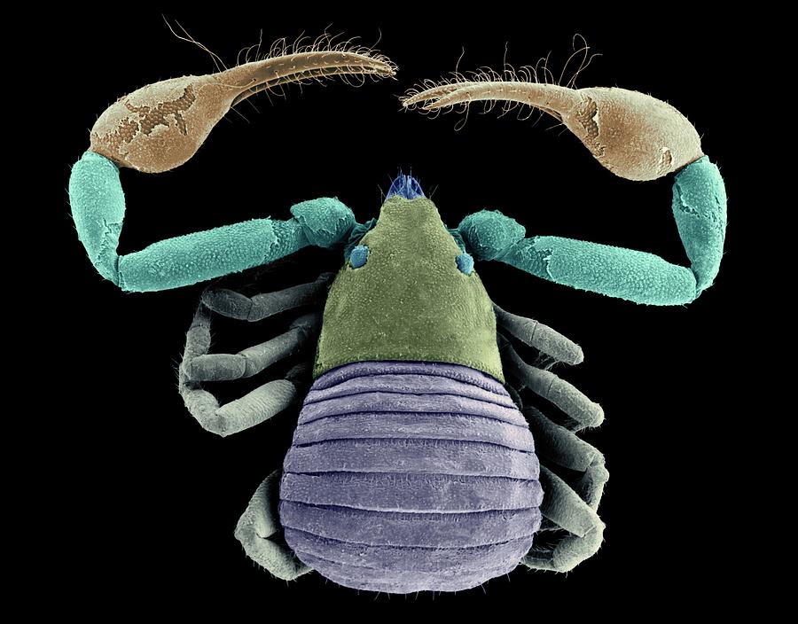 Pseudoscorpion (larca Sp.) #1 Photograph by Dennis Kunkel Microscopy/science Photo Library