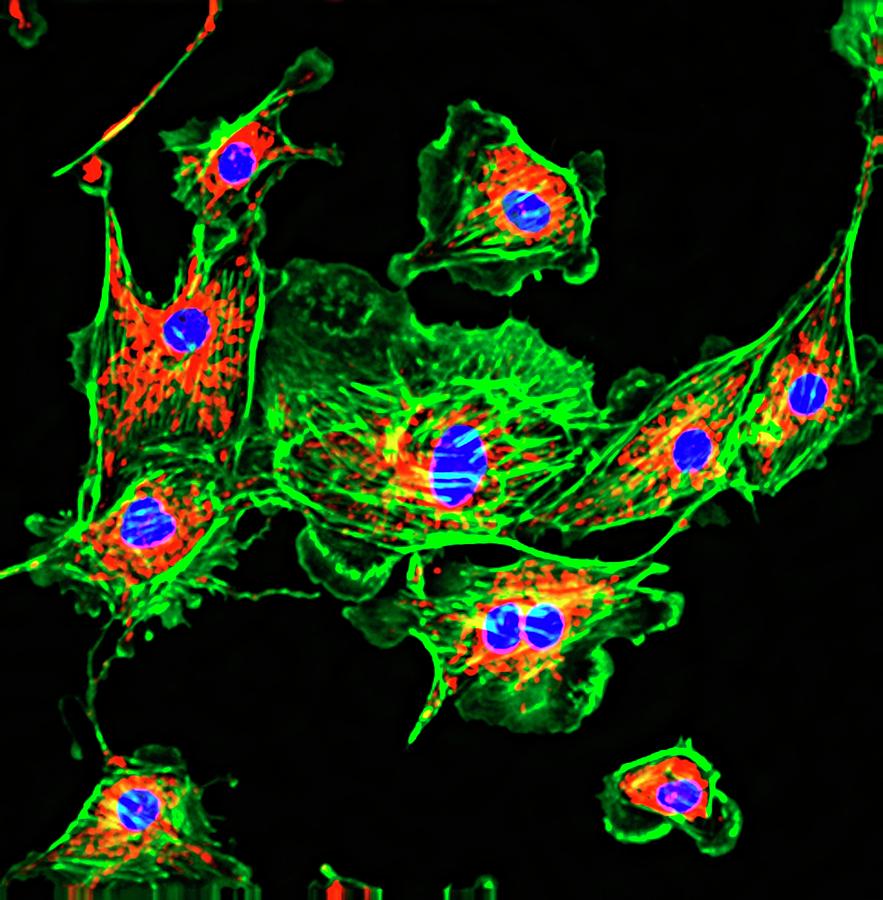 Pulmonary Artery Cells #1 Photograph by R. Bick, B. Poindexter, Ut Medical School/science Photo Library