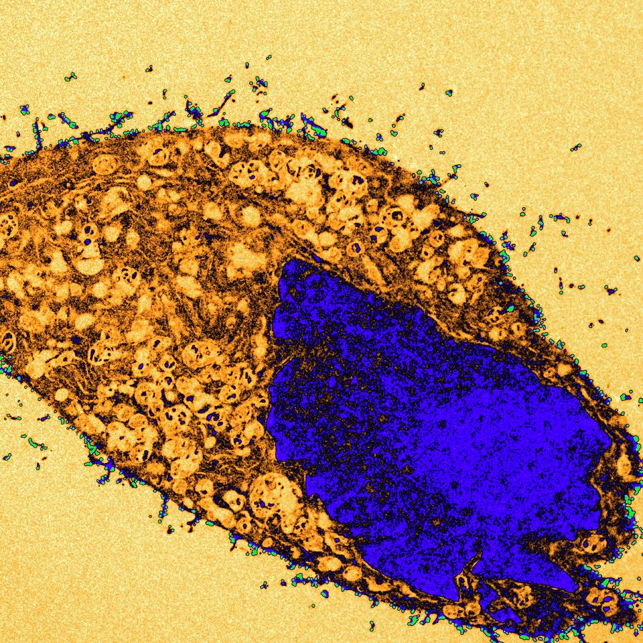 Quantum Dots Cancer Imaging Research Photograph by National Cancer ...