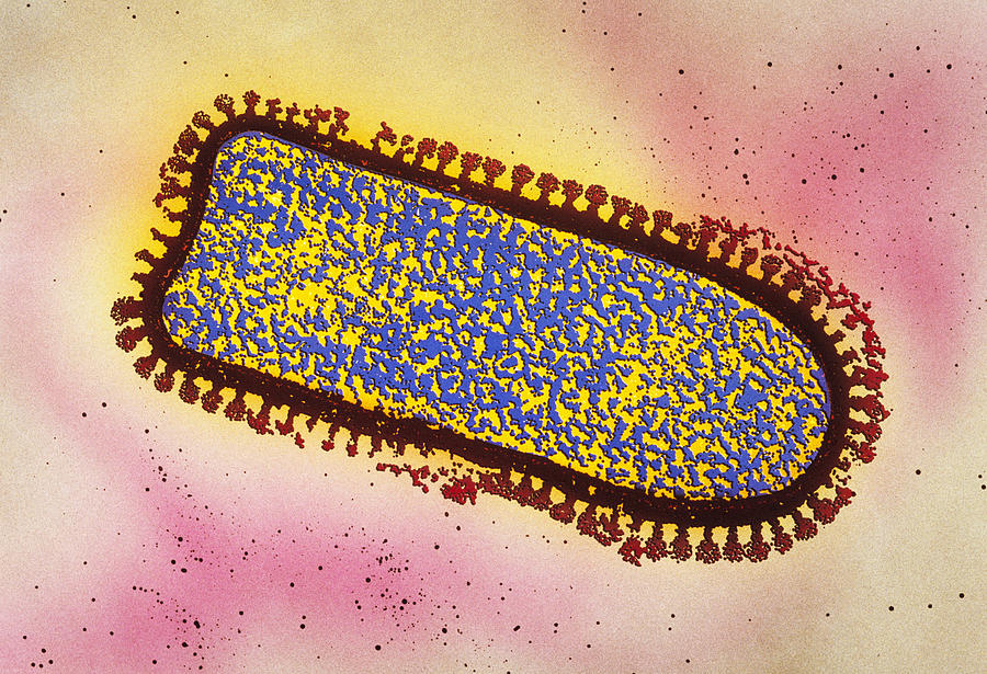 Rabies Virus Under Microscope