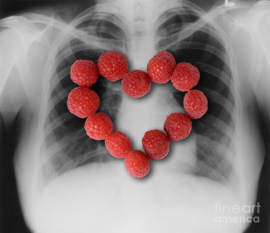 Raspberries, Heart-healthy Fruit #1 Photograph by Gwen Shockey