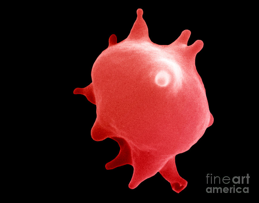 Red Blood Cell In Hypertonic Solution #1 Photograph by David M. Phillips