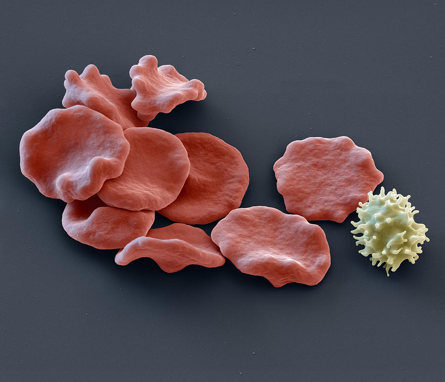 Red Blood Cells And Lymphocyte, Sem #1 Photograph by Eye of Science