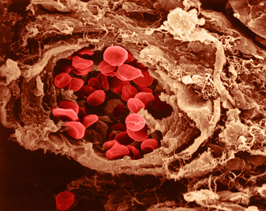 Red Blood Cells, Collagen Fibers, Sem #1 Photograph by Joseph F. Gennaro Jr.
