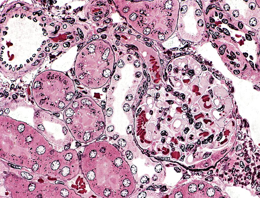 Renal Corpuscle #1 Photograph by Microscape