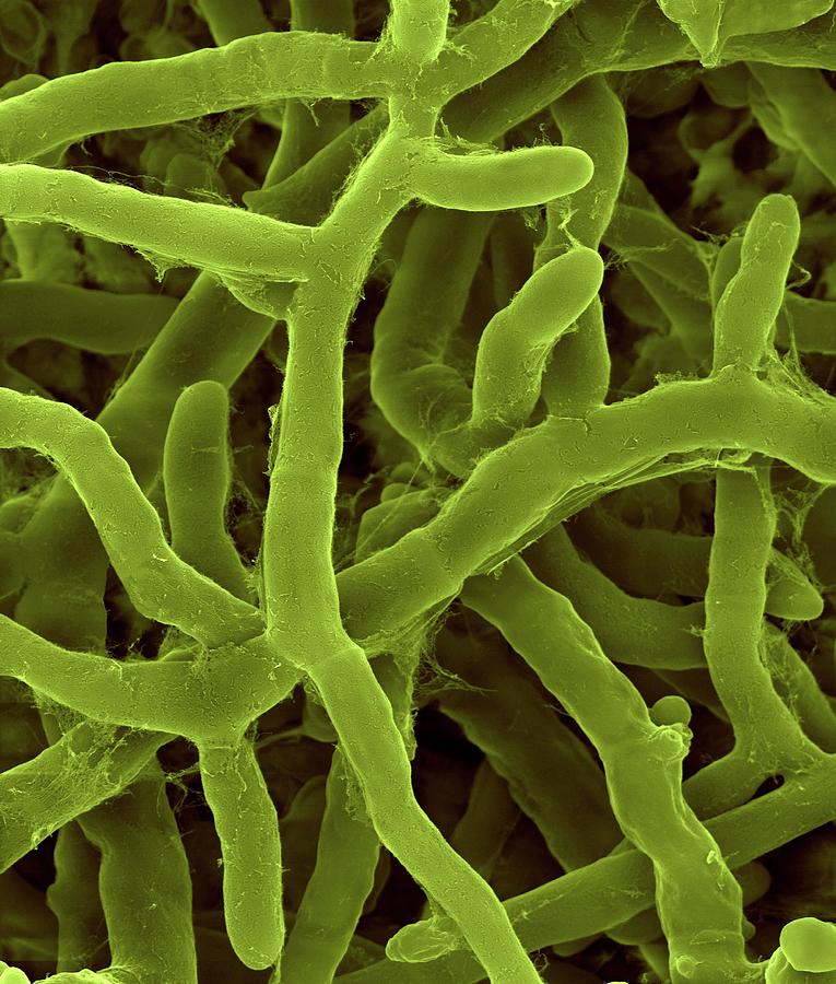 Rhizoctonia Solani Pathogenic Plant Fungus #1 Photograph by Dennis Kunkel Microscopy/science Photo Library