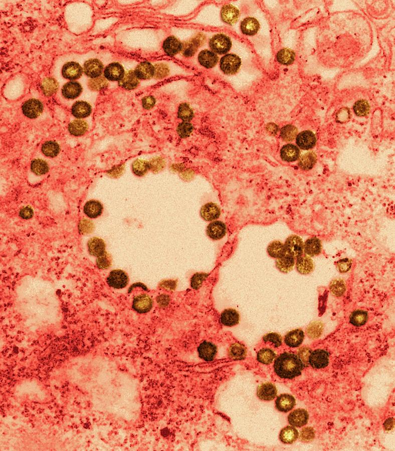 Africa Photograph - Rift Valley Fever Virus #1 by Ami Images/f. A. Murphy; J. Dalrymple