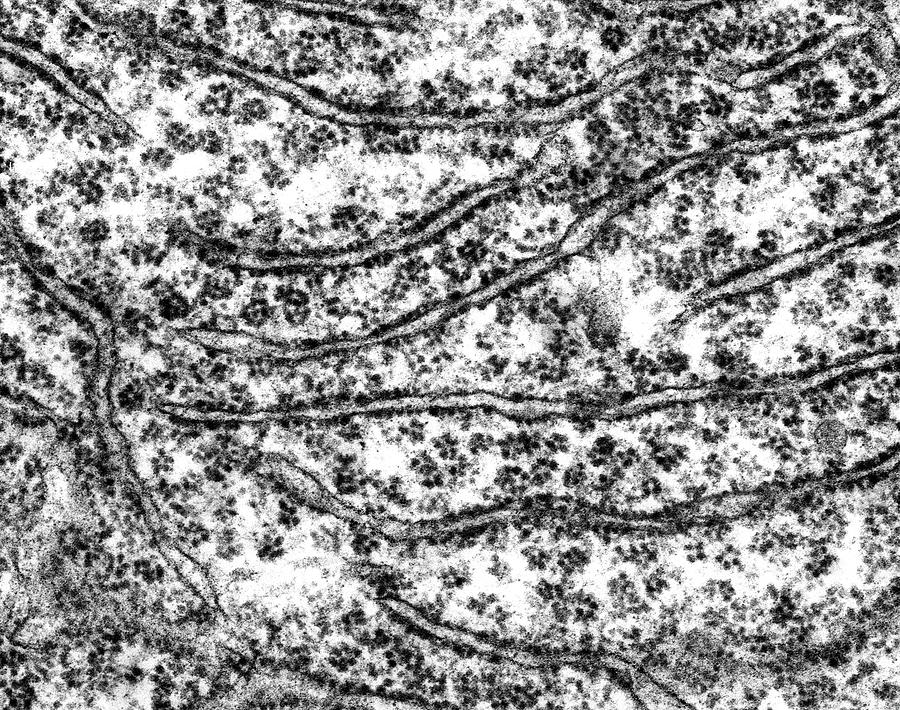 ribosomes microscope