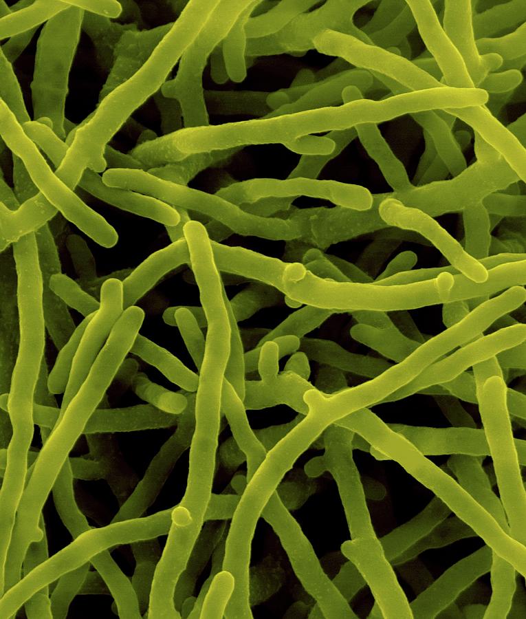 Saccharopolyspora Spinosa #1 Photograph by Dennis Kunkel Microscopy/science Photo Library