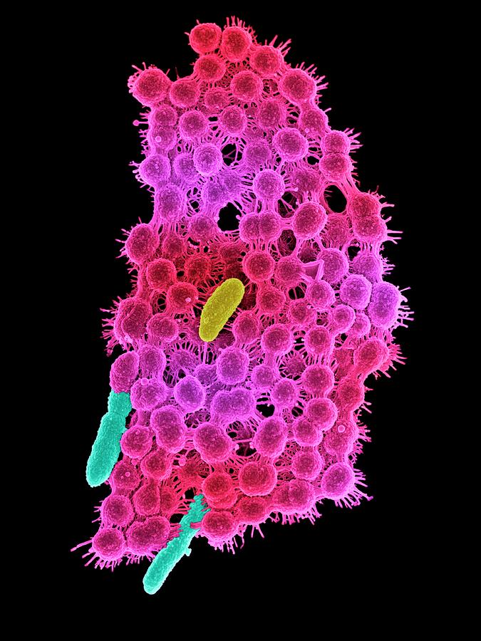 Saliva And Bacteria Photograph by Science Photo Library