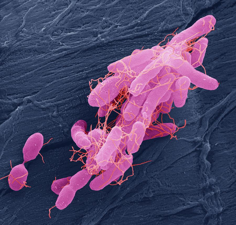 Salmonella Bacteria Photograph by Steve Gschmeissner