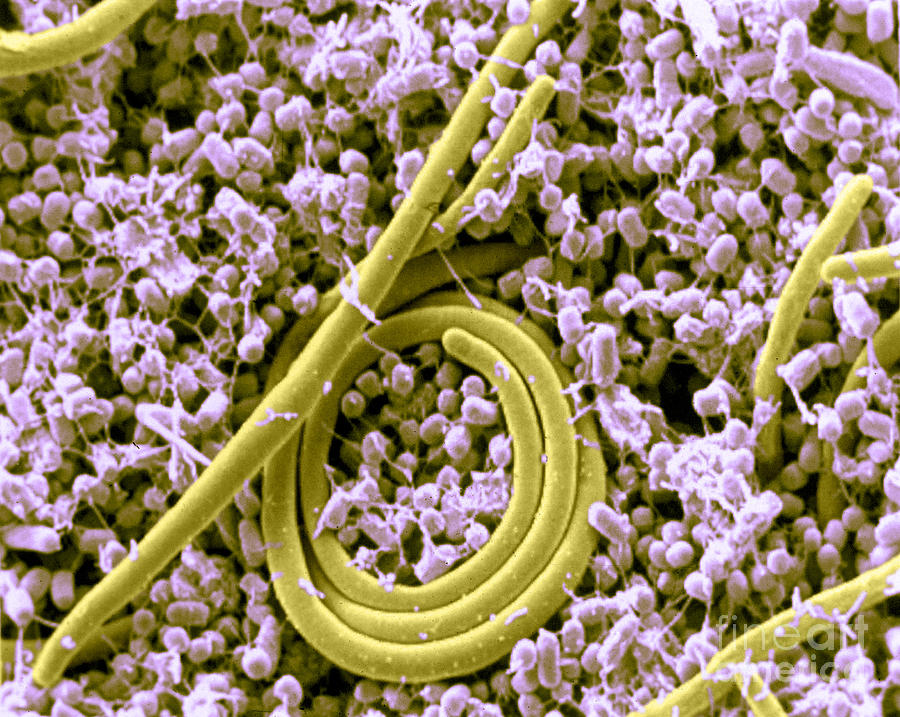 Salmonella Enteritidis, Sem #1 Photograph by Science Source