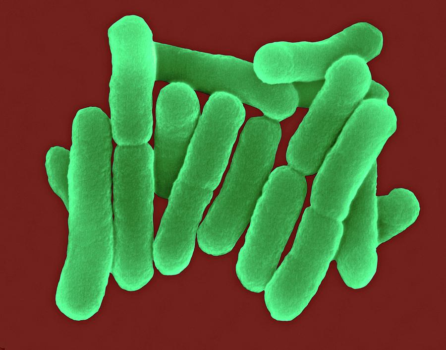 Bacilli Photograph - Salmonella Typhi #1 by Dennis Kunkel Microscopy/science Photo Library
