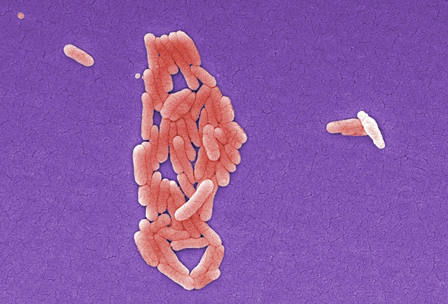Salmonella Typhimurium Bacteria, Sem #1 Photograph by Science Source