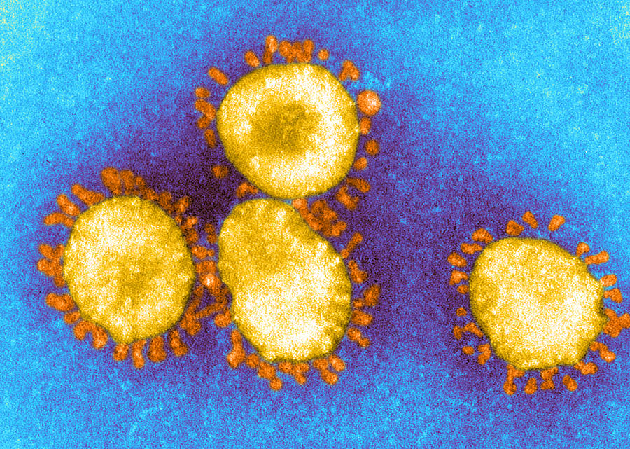 Sars Coronavirus, Em #1 Photograph by Science Source