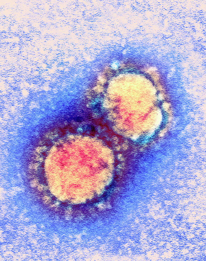  Sars  Virus  Particles Photograph by A Dowsett Public 