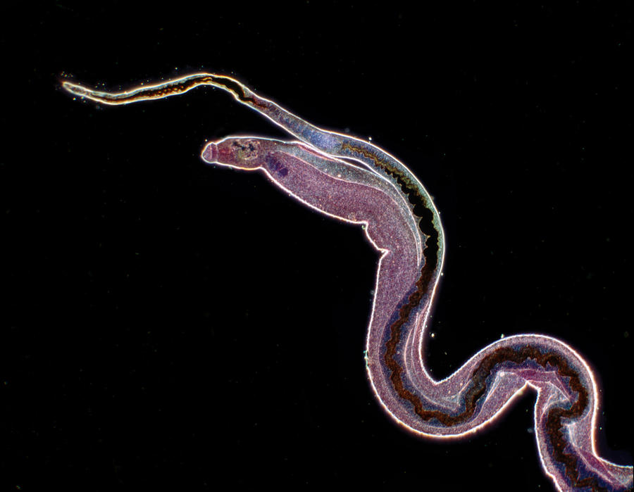 Schistosoma Mansoni #1 Photograph by Eye of Science