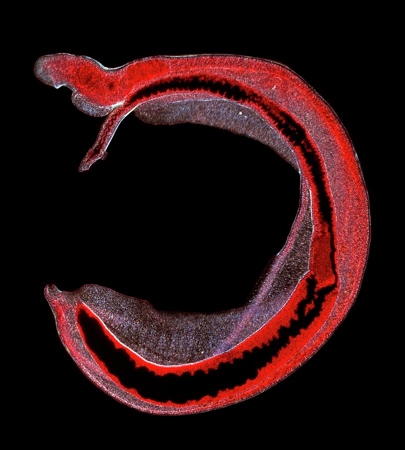 Schistosome Fluke #1 Photograph by Natural History Museum, London/science Photo Library