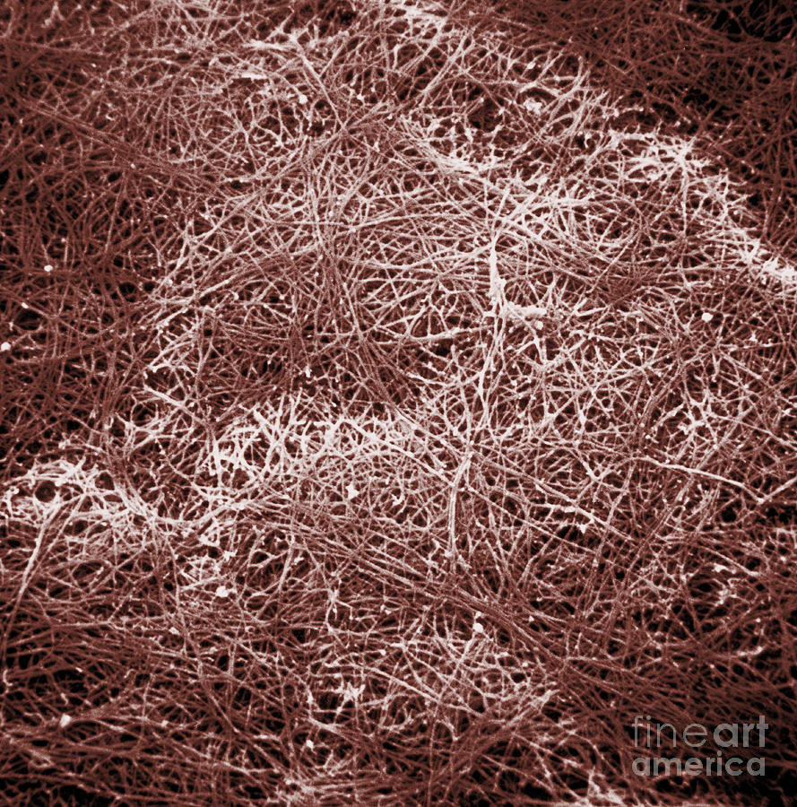 Sem Of Collagen #1 Photograph by David M. Phillips