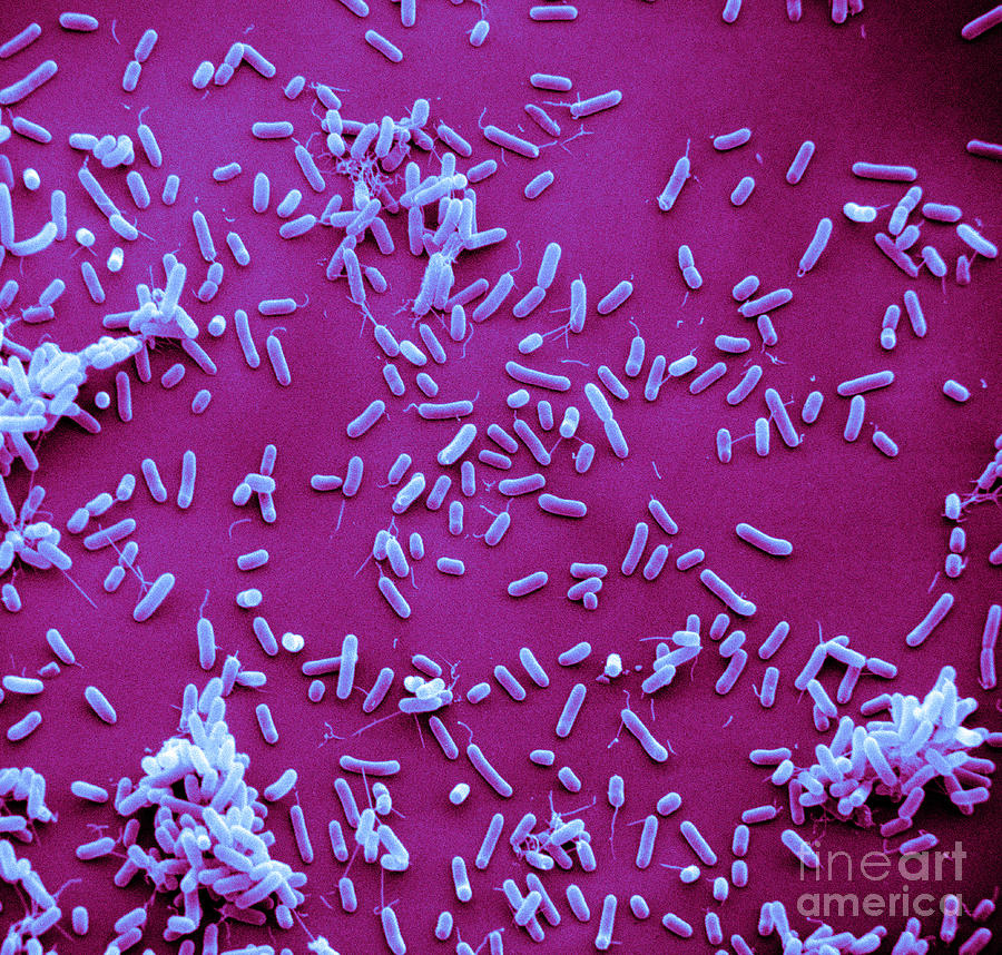 Sem Of Haemophilus Influenzae #1 Photograph by David M. Phillips