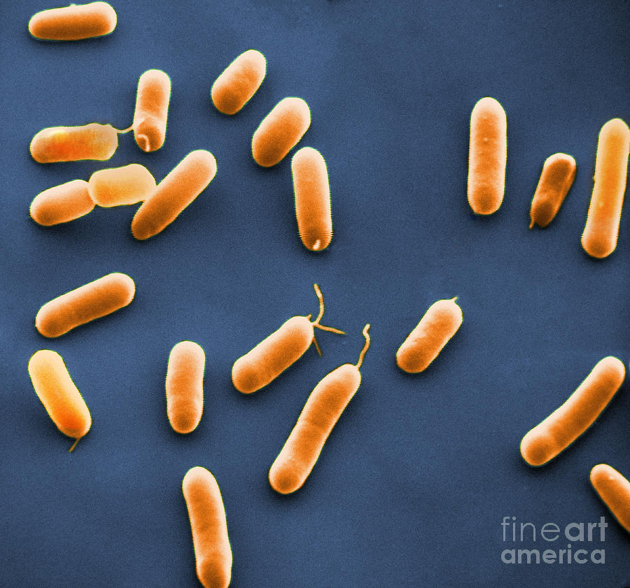 Sem Of Haemophilus Influenzae, Sem Photograph by David M. Phillips ...