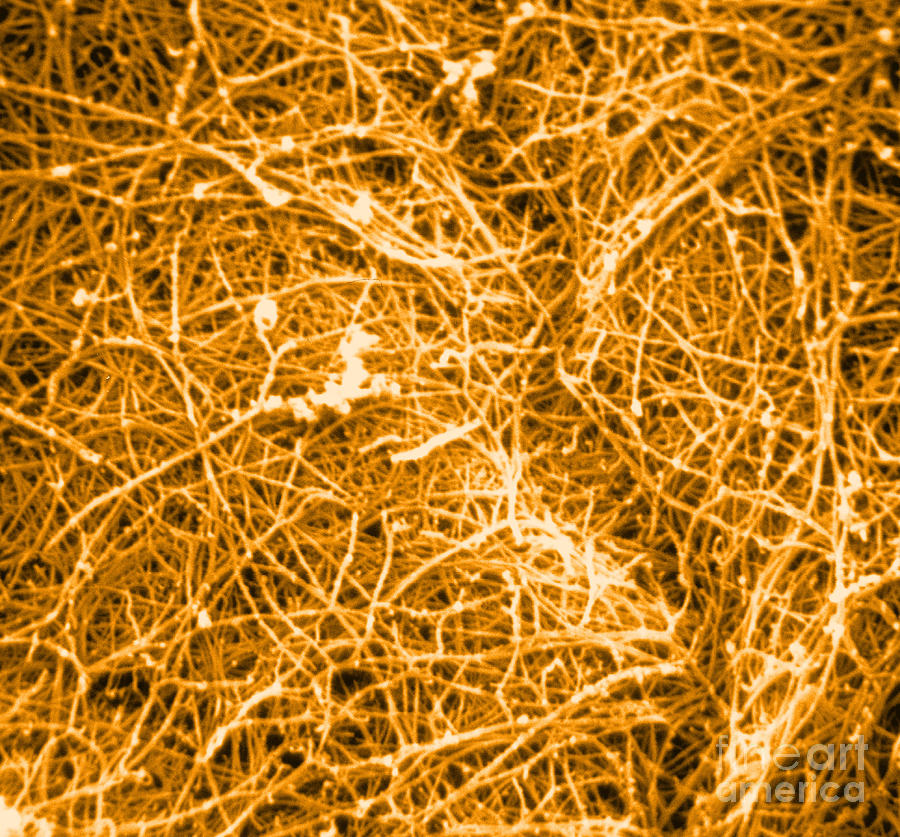 Sem Of Human Collagen #1 Photograph by David M. Phillips