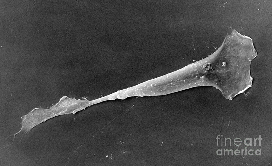 Sem Of Human Macrophage #1 Photograph by David M. Phillips
