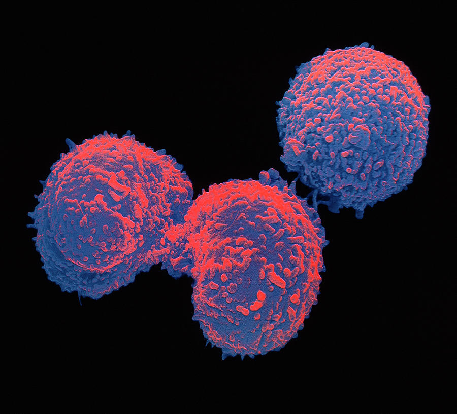 Sem Of Hybridoma Cells Photograph by Dr Jeremy Burgess/science Photo ...