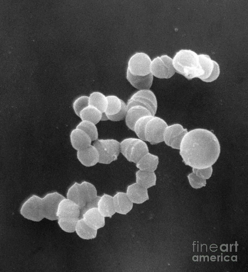 Sem Of Streptococcus #1 Photograph by David M. Phillips