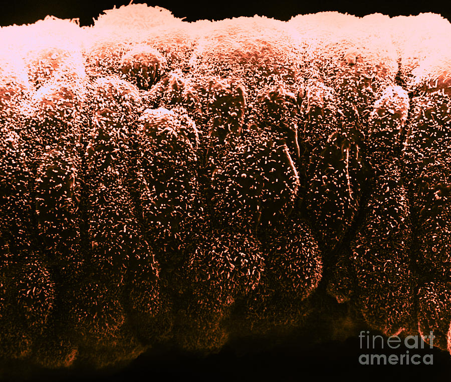 Sertoli Cells From The Testis, Sem #1 Photograph by David M. Phillips