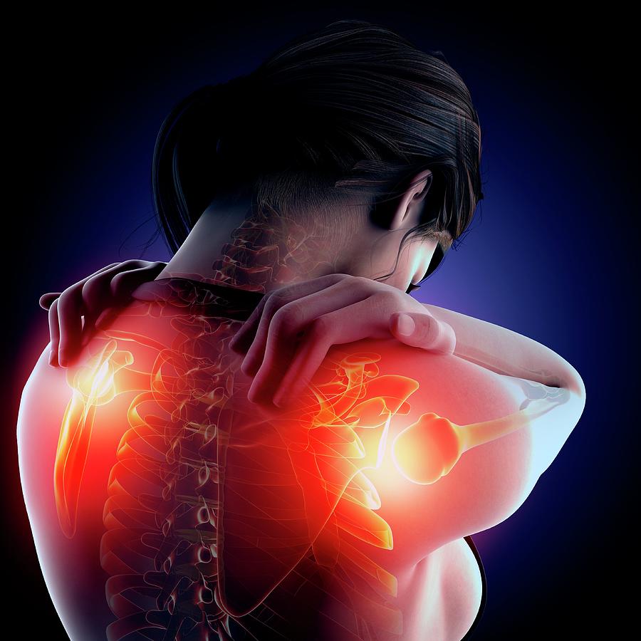 Shoulder Pain #1 Photograph by Pixologicstudio/science Photo Library