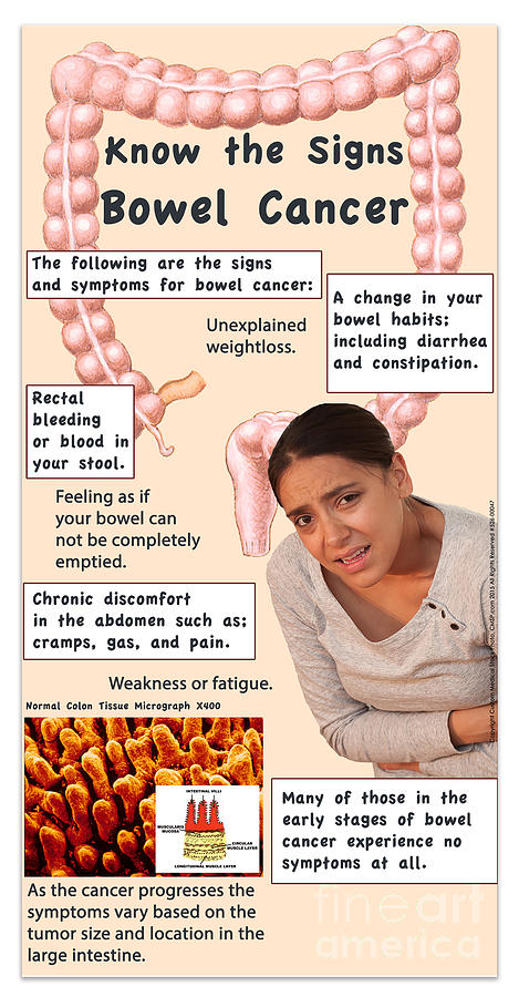 colon cancer stool pictures