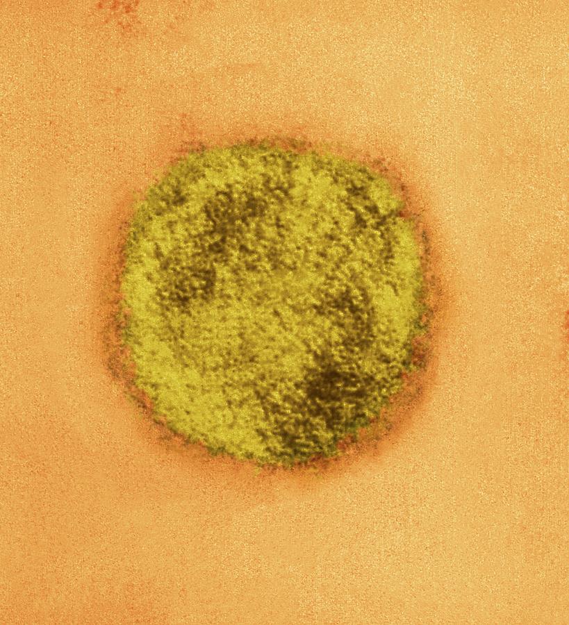 Biological Photograph - Sin Nombre Virus Particle #1 by Ami Images/charles D. Humphrey, Luanne Elliott