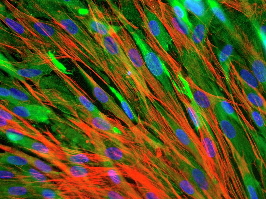 Skeletal Muscle Cells #1 Photograph by Daniel Schroen, Cell Applications Inc
