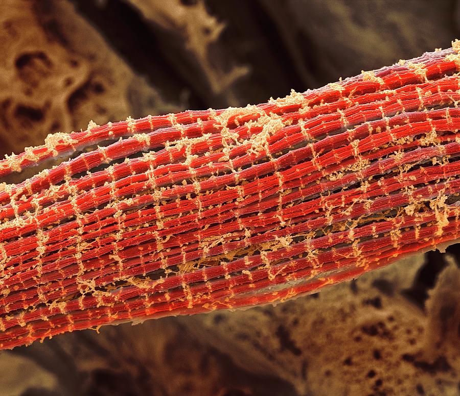 Skeletal Muscle Fibres #1 Photograph by Steve Gschmeissner