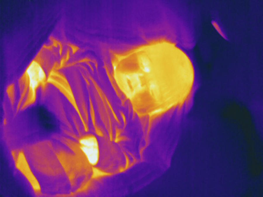 Sleeping Infant, Thermogram #1 Photograph by Science Stock Photography