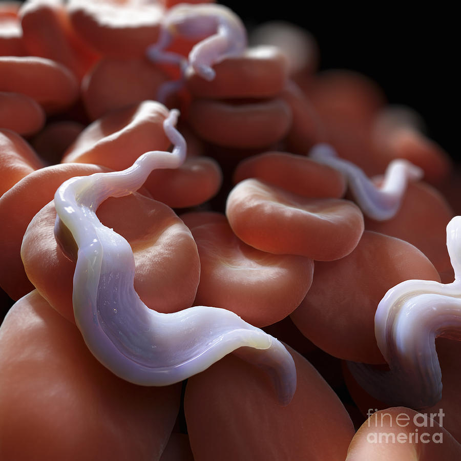 Infection Photograph - Sleeping Sickness Infection #1 by Science Picture Co