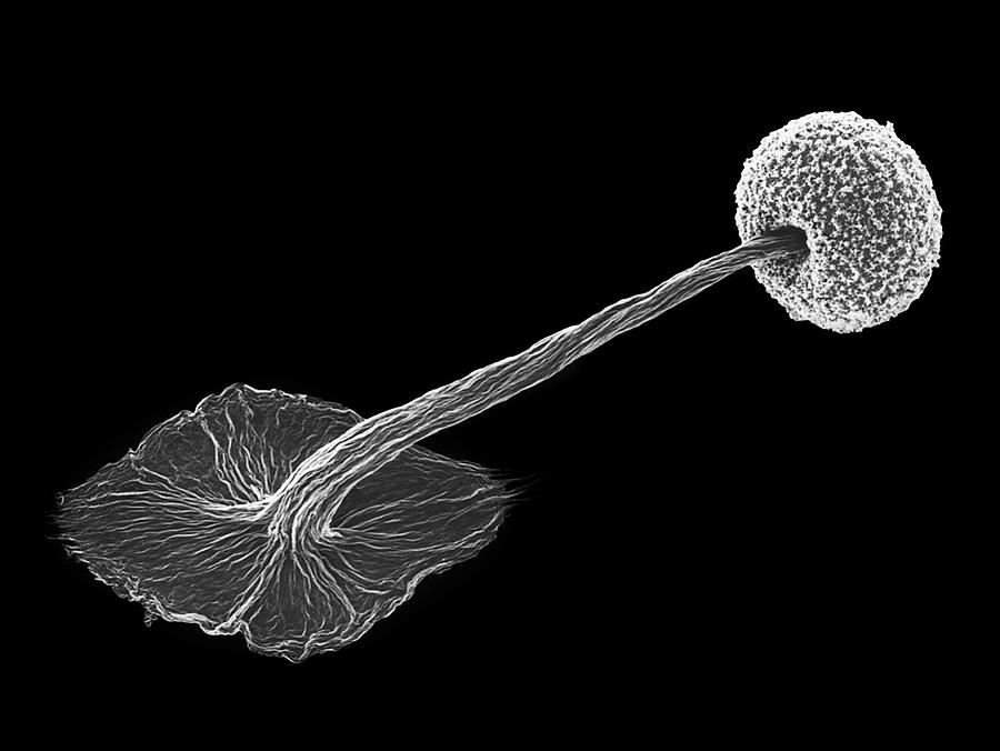 Slime Mould Sporocarp (didymium Sp.) #1 Photograph by Dennis Kunkel Microscopy/science Photo Library
