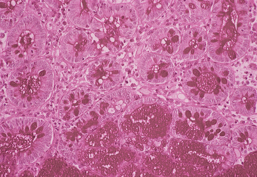 Small Intestine Lining #1 Photograph by Cnri/science Photo Library
