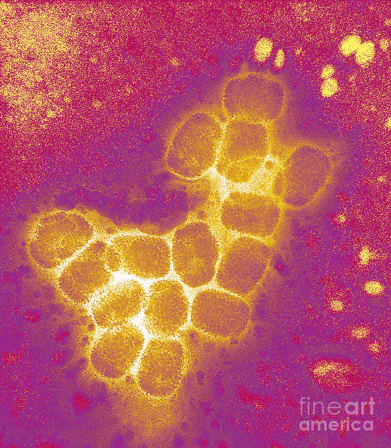 Smallpox Virus #1 Photograph by Scott Camazine